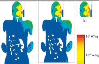 interazioni e effetti dell'esposizione alle radiazioni non-ionizzanti sul corpo umano